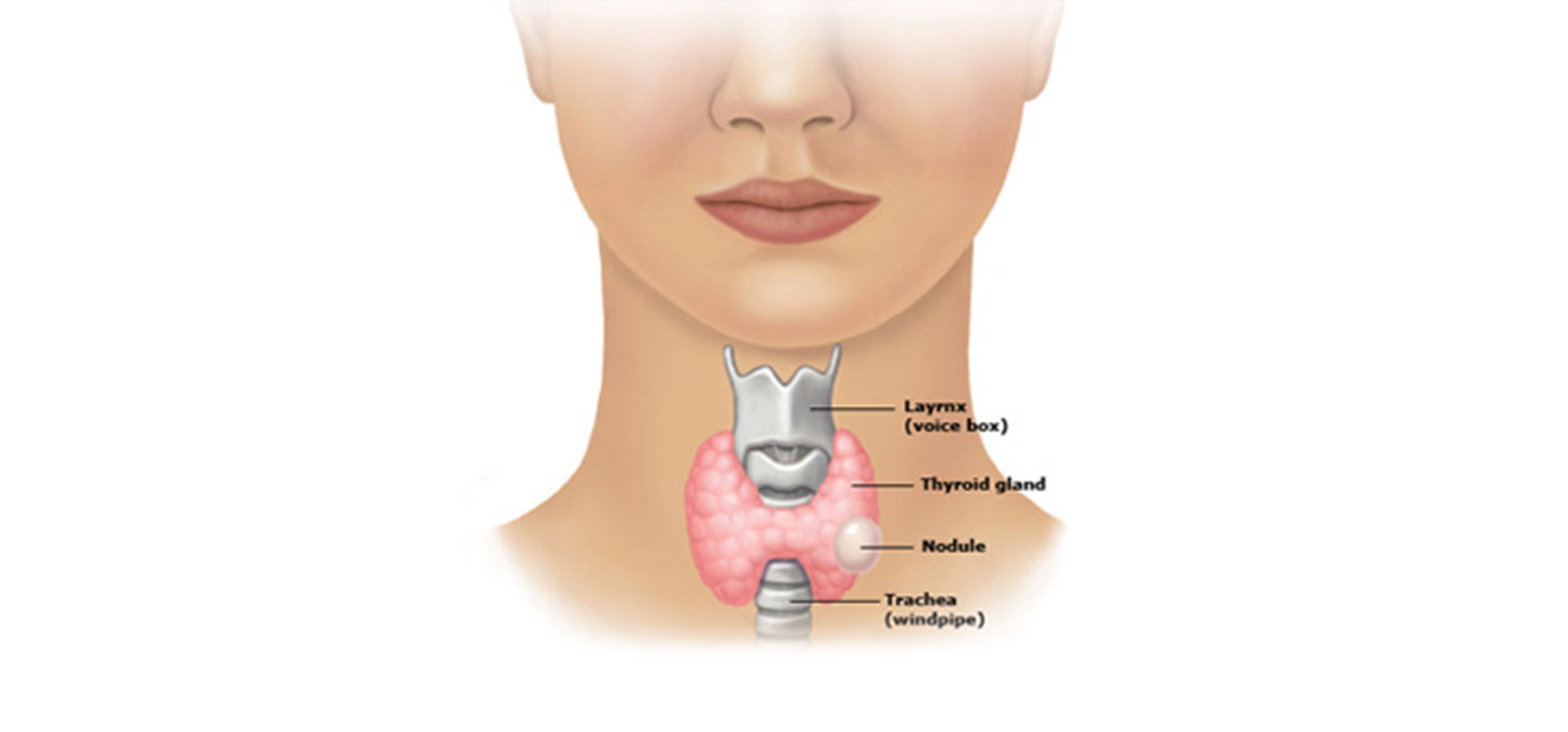 Thyroid Surgery